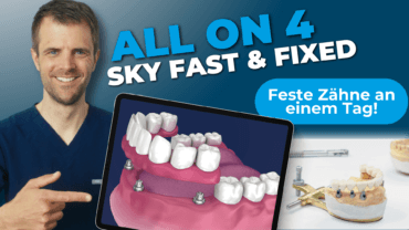 SKY fast & fixed Implantationsmethode