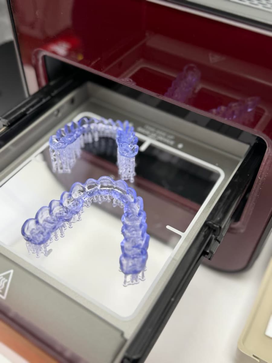 Frisch gedruckte Aufbissschienen direkt aus dem 3D-Drucker